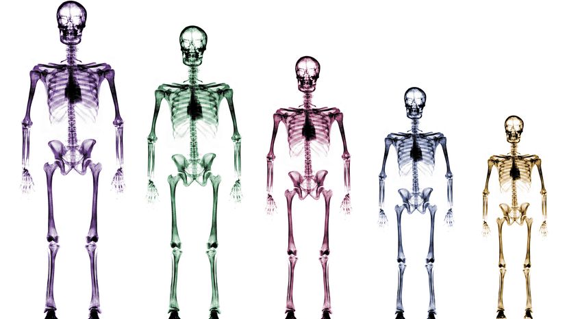 Family of human skeletons