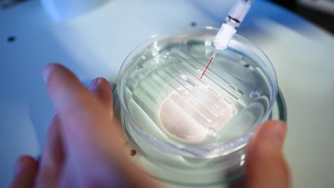 How CRISPR Gene Editing Works - Vimarsana News