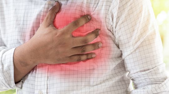 Could you have a heart attack -- and not know it?