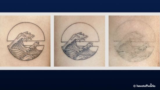 尝试没有承诺的纹身＂class=