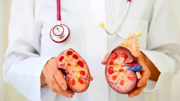 A doctor holding a kidney teaching model. 