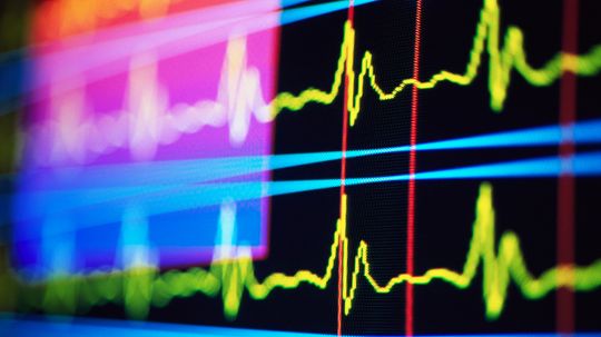 How do you treat atrial fibrillation?