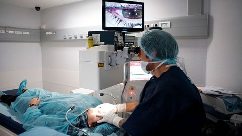 How Long Does LASIK Last? - Vimarsana News