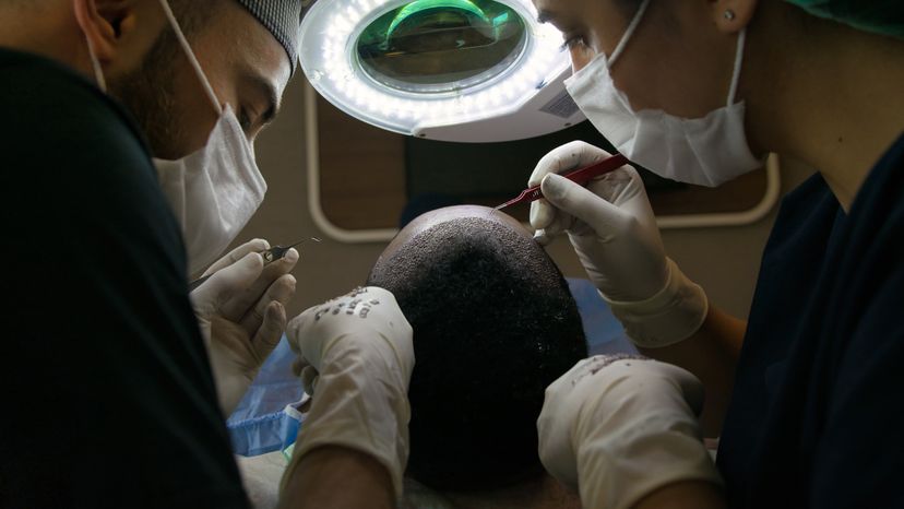 A man undergoing hair transplant surgery.