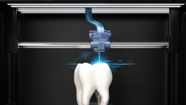 A 3D printer printing a tooth. 