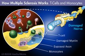 T-cells and monocytes