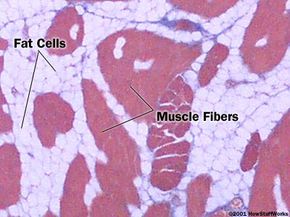 Cross section of a skeletal muscle (200x) showing the muscle fibers (red) and the fat cells (white)