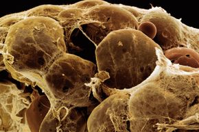 Fat cells - shown here surrounded by collagen fibers - don't just sit there. Aside from providing the body with energy, they also produce hormones.