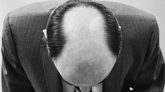 Why Arenâ€™t There More Patterns in Male Pattern Baldness?