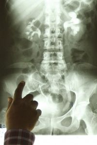 X-rays are a part of Medicaid's mandatory coverage. 