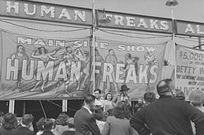 Sideshows may have mislabeled their performers as “freaks,” but the entertainers had medical conditions that were truly fascinating and anomalous.