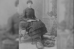 Fanny Mills had Milroy disease, which caused lymphedema in her lower body.