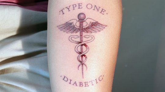 Are There Medical Reasons to Get a Tattoo?