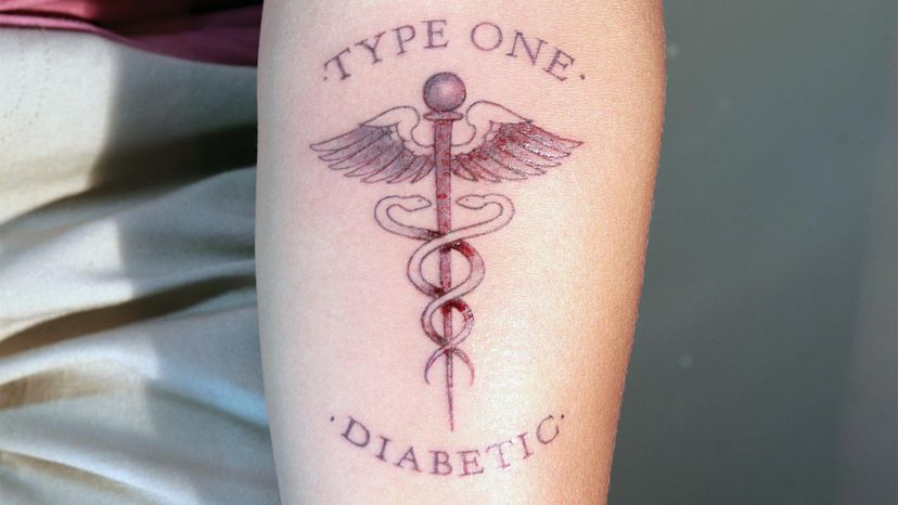 medical tattoo