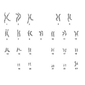 A karyotype, or chromosome &quot;map,&quot; for a typicalhuman male