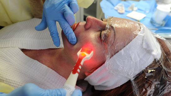 微针对你的皮肤有什么好处?＂class=