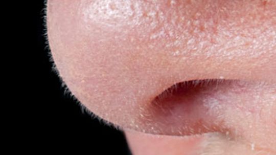 How to Minimize Your Pores