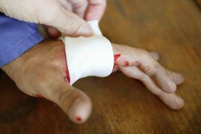 Before you apply that bandage, should you moisturize the wound?