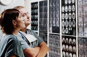 Doctors examine the contrasts on an MRI scan.