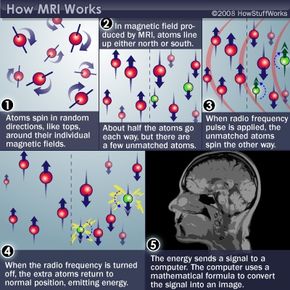The steps of an MRI