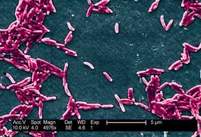 Scanning electron micrograph (SEM) of Campylobacter fetus bacteria, magnified 4,976 times