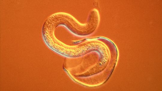 Nematodes: Do We Still Need to Worry About Roundworms and Bare Feet?