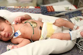 NICU baby with monitor