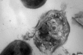 的细菌细胞后看起来像一个忍者粒子已在:出现(或细胞溶解)。”width=