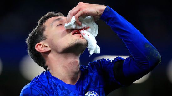 止鼻血的最好方法是什么?＂class=