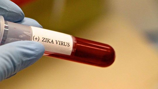 Keeping Zika Out of the U.S. Blood Supply