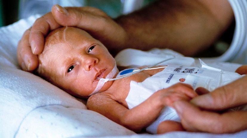 New research shows that premature babies born between the 22nd and 24th weeks of pregnancy are more likely to survive, and less likely to have health issues. John Cole/Science Photo Library/Getty Images