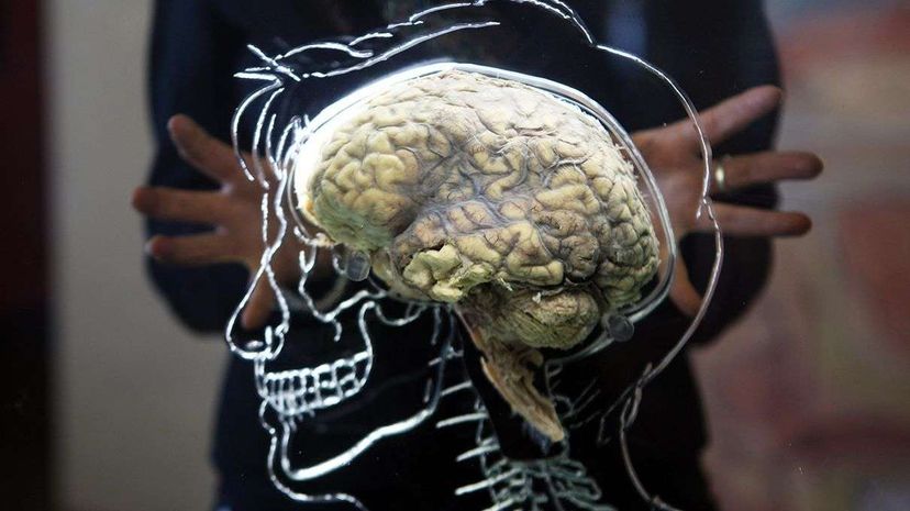 A human brain on display at the @Bristol exhibit in Bristol, England. Matt Cardy/Getty Images