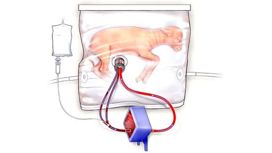 “生物袋”中的胎儿羊羔有望成为人工子宫18新利最新登入＂class=
