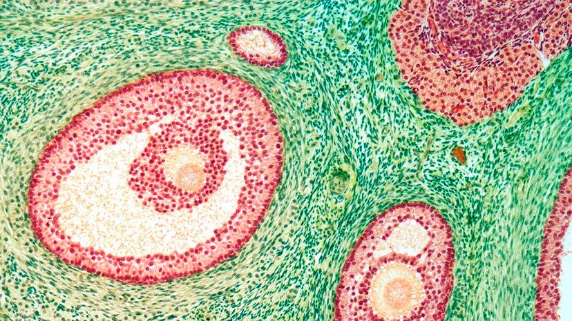 A light micrograph highlights ovarian follicles. Scientists had thought that the common disorder likely started in the ovaries, but it turns out that may not be the case. STEVE GSCHMEISSNER/Science Photo Library/Getty Images