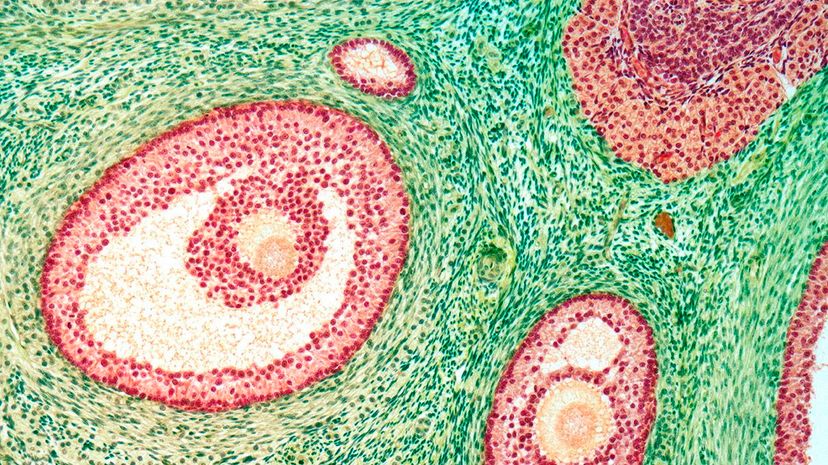 光学显微照片突出显示卵巢卵泡。科学家们认为这种常见疾病可能始于卵巢，但事实证明情况并非如此。史蒂夫·格斯梅斯纳（Steve Gschmeissner）/科学图书馆/盖蒂图像“width=