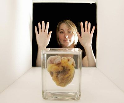 heart transplant display