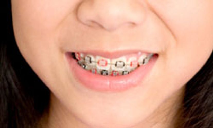 The Ultimate Orthodontics for Kids Quiz