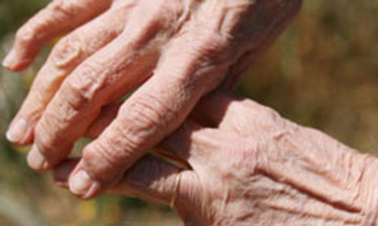 很容易应付轻度脊柱的骨关节炎吗?”class=