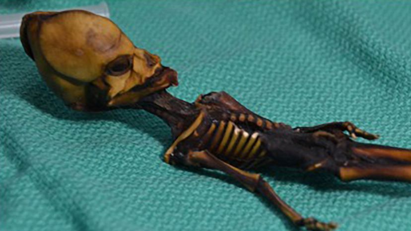 atacama skeleton