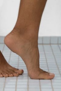 You can get tinea, the fungal infection that causes athlete's foot, practically anywhere on your skin.