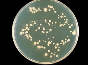 Some believe that an overgrowth of the yeast Candida albicans (which naturally occurs in the body) can damage the intestines of children with autism.