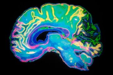 colored mri brain scan