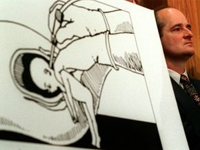 Rep. Charles Canady of Florida stands next to a poster illustrating the dilation and extraction method in 1995.