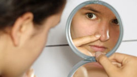 Acne Remedies: Fast Facts