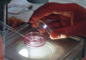 A doctor fertilizes a woman's eggs for in vitro fertilization.