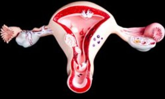 子宫癌诊断＂class=