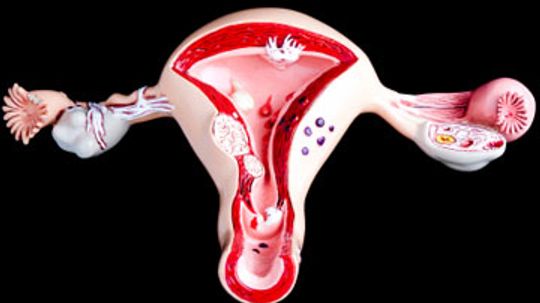 Adenomyosis and Fertility