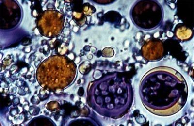 algae biodiesel close-up