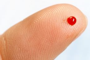Blood may be an integral part of your body, but it is possible to be allergic to it. 