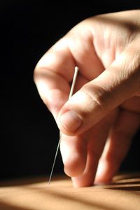 It's unlikely that your insurance company will approve your acupuncture treatments.